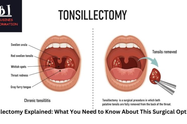 Tollectomy Explained: What You Need to Know About This Surgical Option